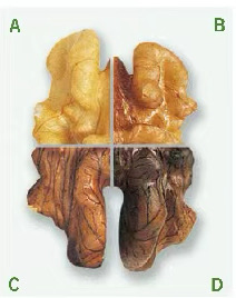 核桃仁颜色分类图示